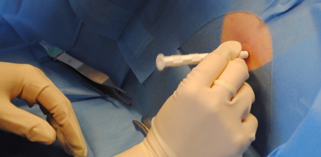 skin biopsy