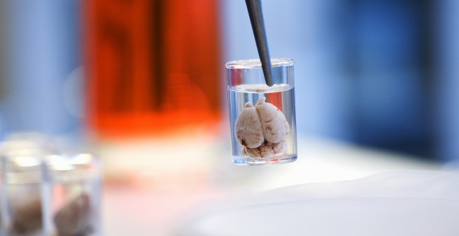 Neuropatho